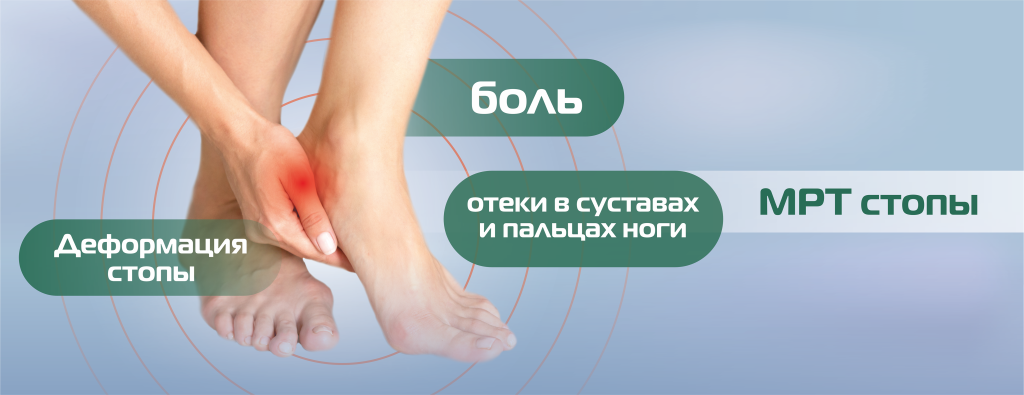 МРТ_нижние конечности, стопа(БЕЗ ЦЕНЫ) (4).png