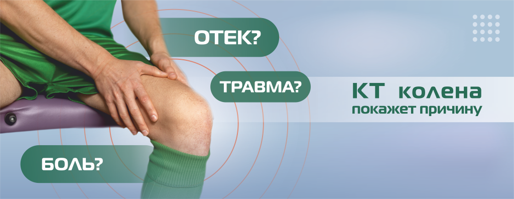 КТ_нижние конечности, коленный сустав.png